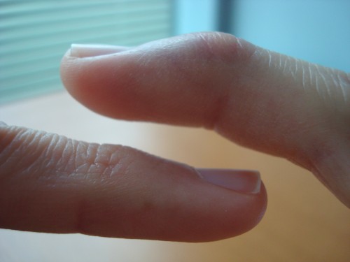 Comparing Pinky Fingers Side By Side